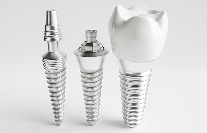 Dental implant components